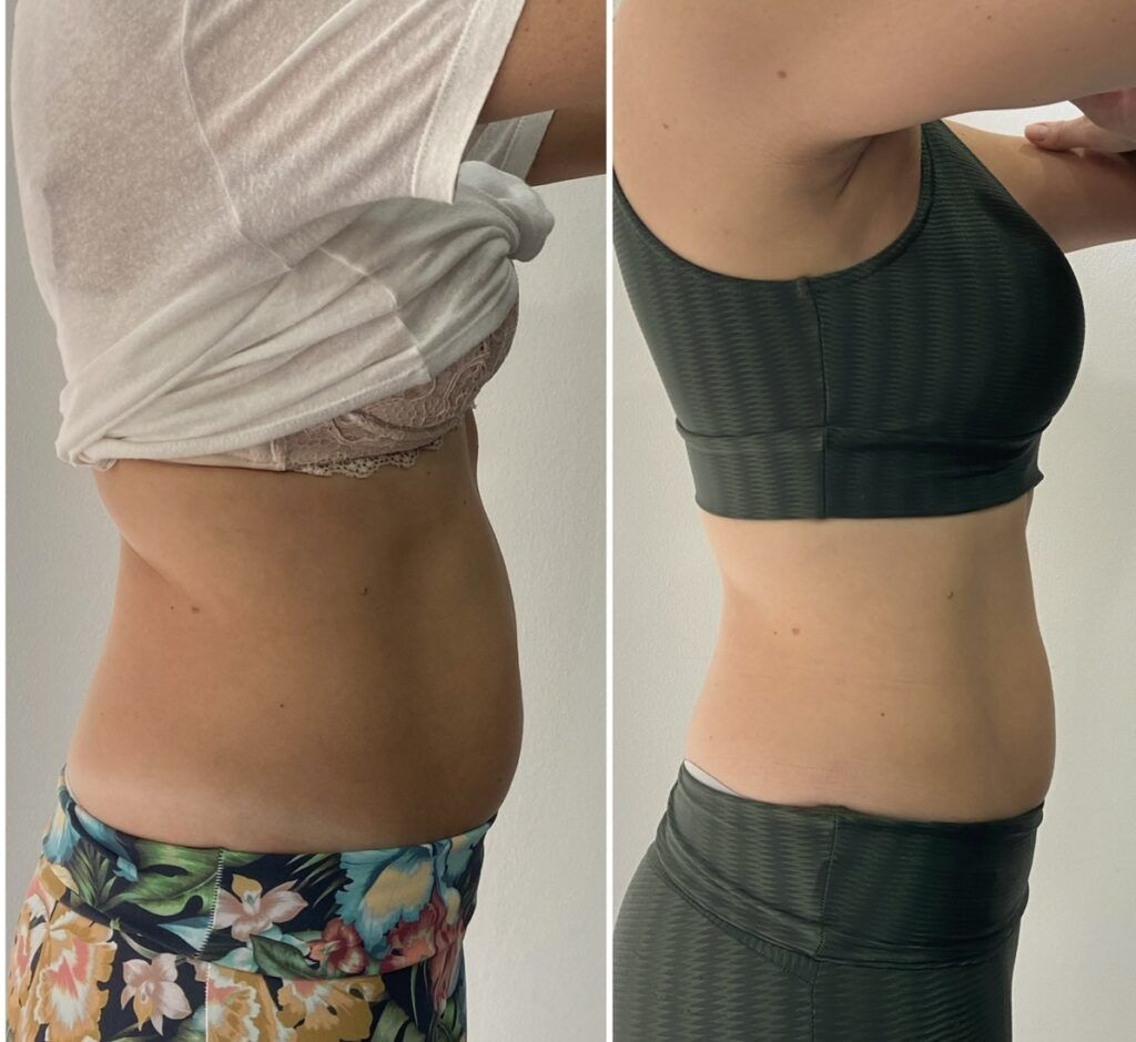 Vela Shape tulemused - enne ja pärast 4