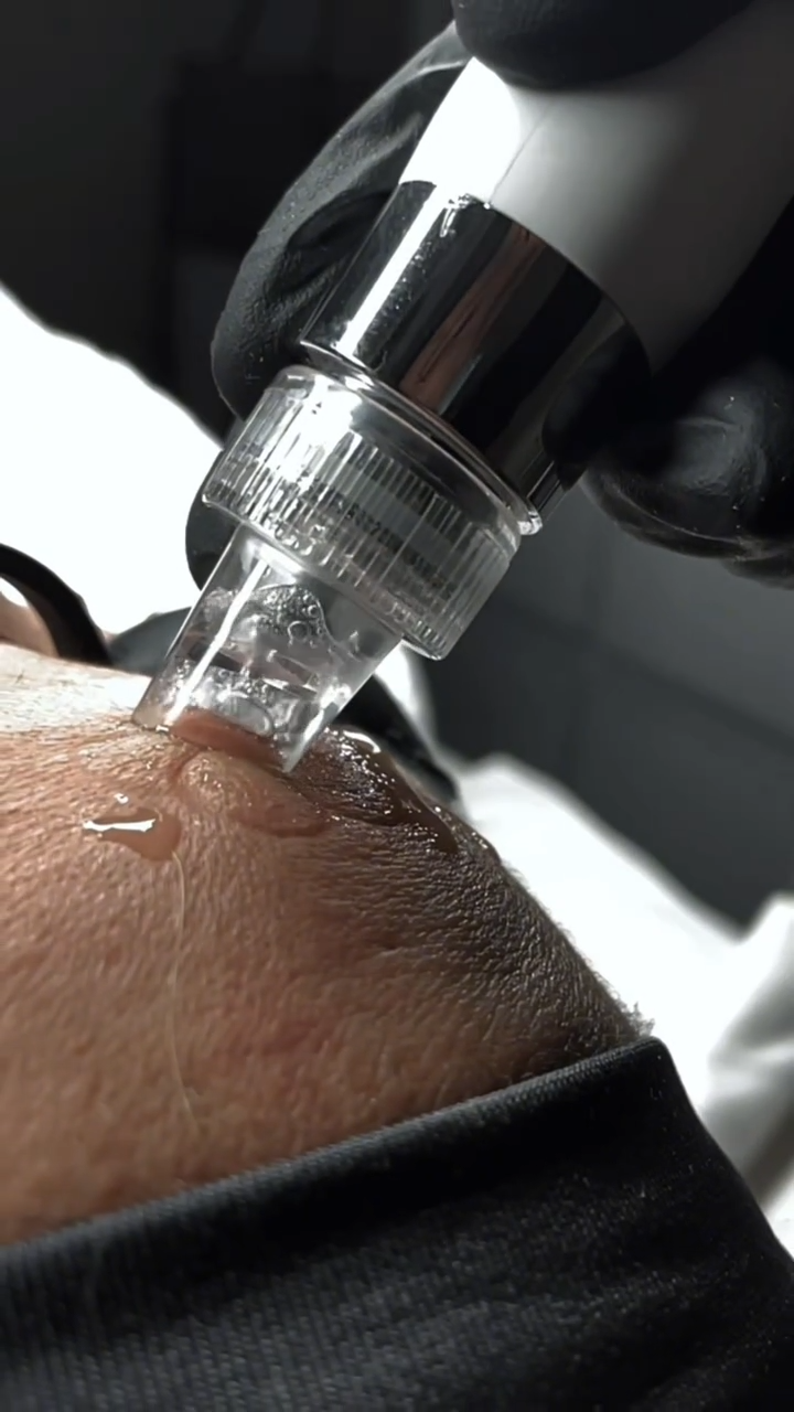 Premium Hydrafacial hooldused